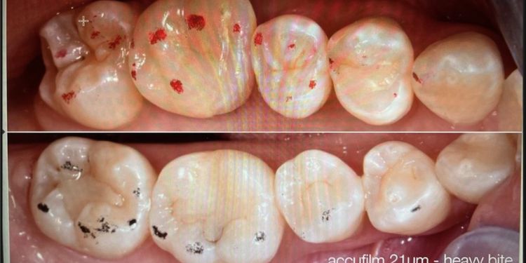 Journal of Dentistry And Oral Implants-Occlusion